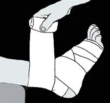 Illustration af bandage der vikles om fod