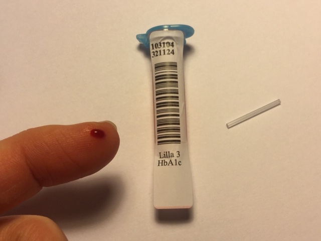 Billede af bloddråbe på finger, glas og rør.