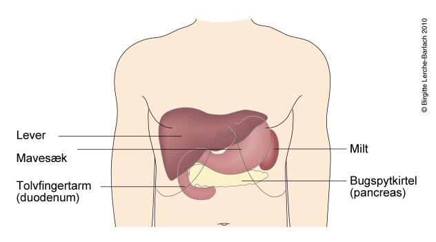 Illustration der viser blødende mavesår