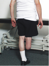 Person med et underben amputeret står og holder balancen på et ben