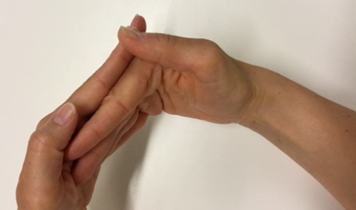Billede af to hænder. Den anden hånd har strakte fingre, men bøjer  60 grader i grundleddene og 30 grader i håndleddet. Den anden hånd støtter på fingrenes bagside