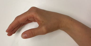 Hånd som holdes bøjet 30 grader i håndleddet og 20 grader i tommelfingerens grundled