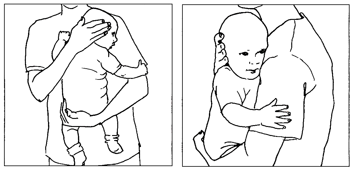 Tegninger af et barn som bæres ind mod brystet så hovedet holdes drejet til højre