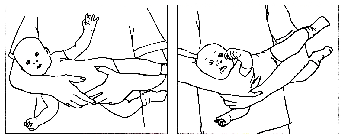 Tegninger af voksen som bærer barnet sidelæns med ryggen ind mod brystet, hvor hovedet vippes mod venstre
