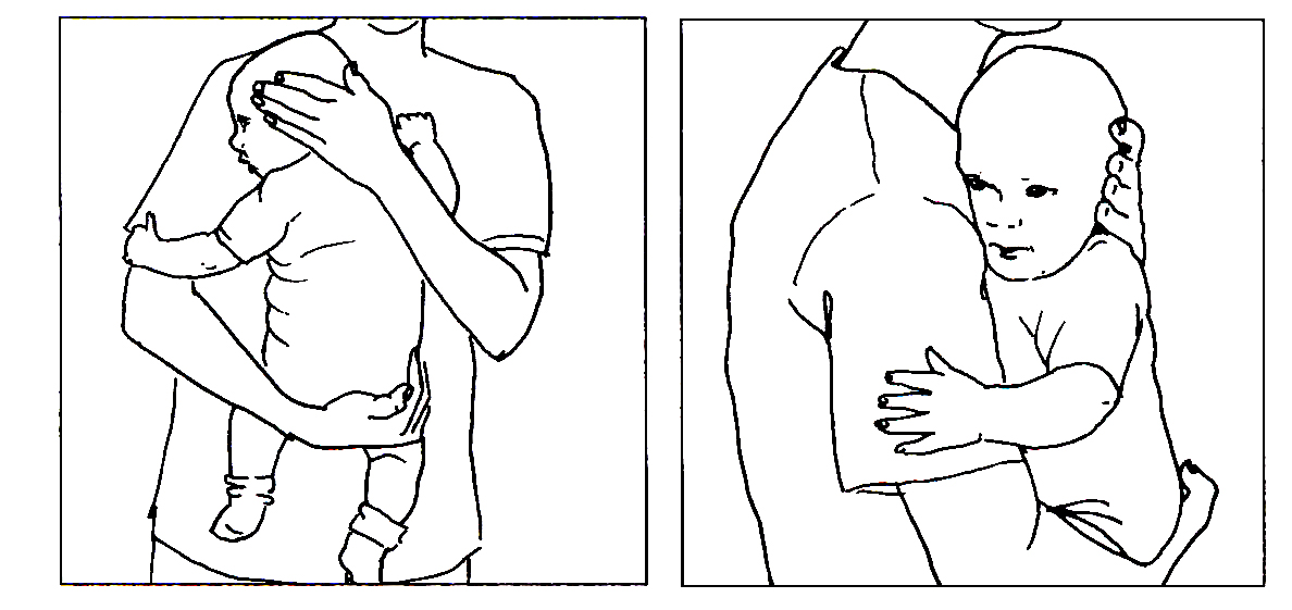 Tegning af børn der bæres ind mod brystet så hovedet er drejet mod venstre