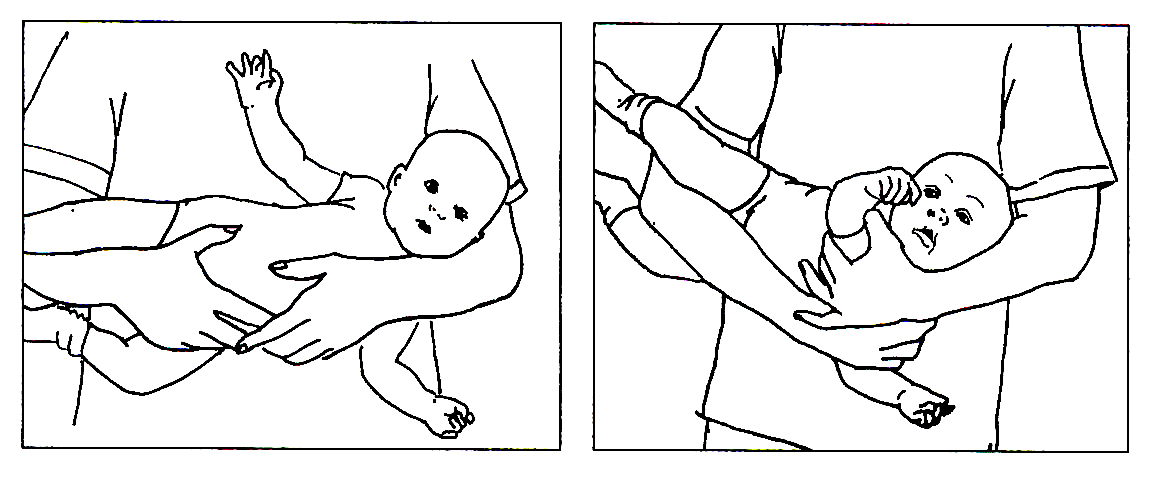 Tegning af barn der bæres liggende på siden og tegning af hvor barnet i denne stilling får hovedet bøjet lidt til højre