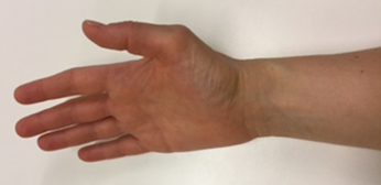 H&aring;nd viser &oslash;velse 9