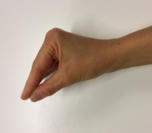 Hånd som bøjer fingrene i grundleddene med strakte fingre