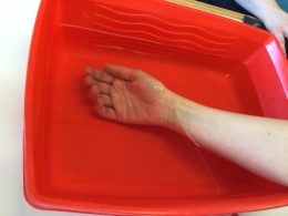 Hånd opvarmes i en balje med vand.