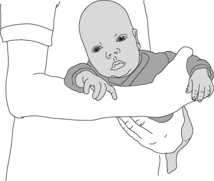 Tegning af baby som bæres liggende på maven og overkroppen skråt opad