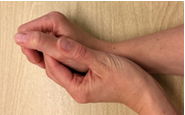 En hånd holder om den anden tommelfinger, hvor håndleddet er bagudbøjet