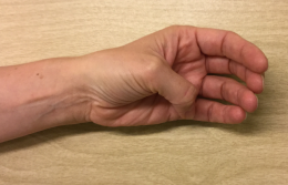 Tommelfingeren føres ned mod basis af lillefinger.