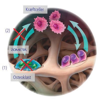 Figuren viser, hvordan zoledronsyre virker.