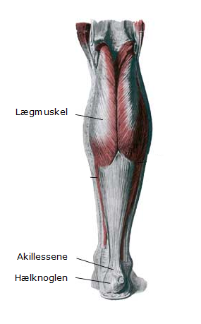 Akillessenen forbinder hælknoglen med lægmusklen.  Bristningen sker hyppigst 3-6 cm over hælknoglen.