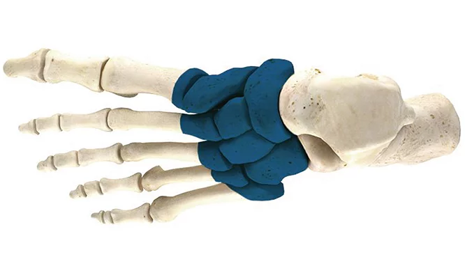 Mellemfodens rodled - TMT artrodese.png