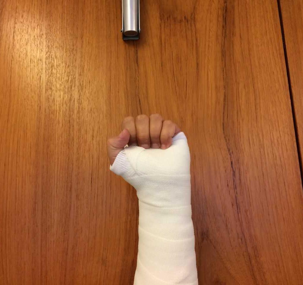 Vinkel gips venepumpeøvelser 2.jpg