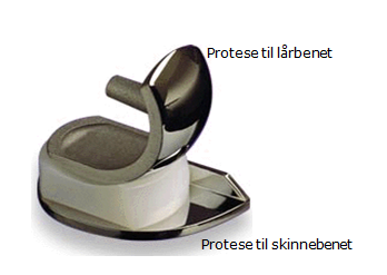 Billede af en del-kn&aelig;protese