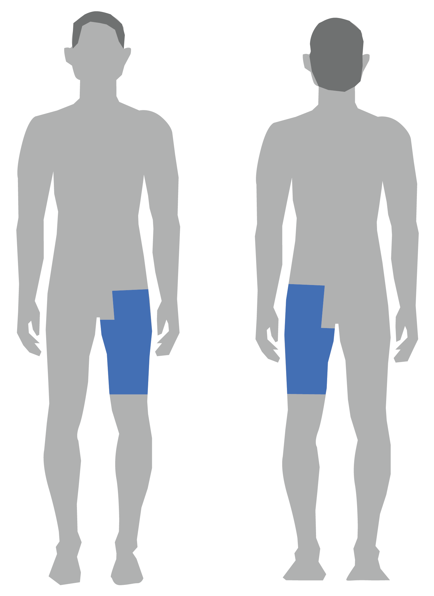 Illustration der viser hvor der skal fjernes h&aring;r f&oslash;r hofteoperation