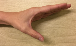 Billedet viser udadføring af tommelfingeren.